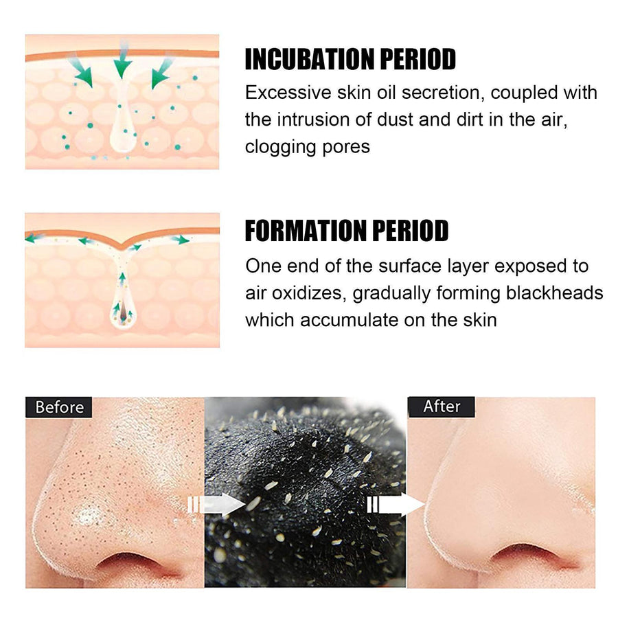 Deep-Clean Nose Pore Strips – Blackhead Removal, 10 Pack