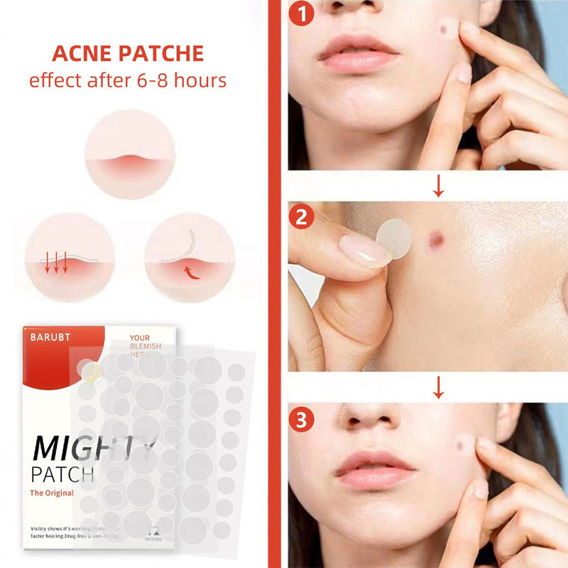 Overnight Pimple Patches – Shrink Zits & Whiteheads While You Sleep, 72 Count
