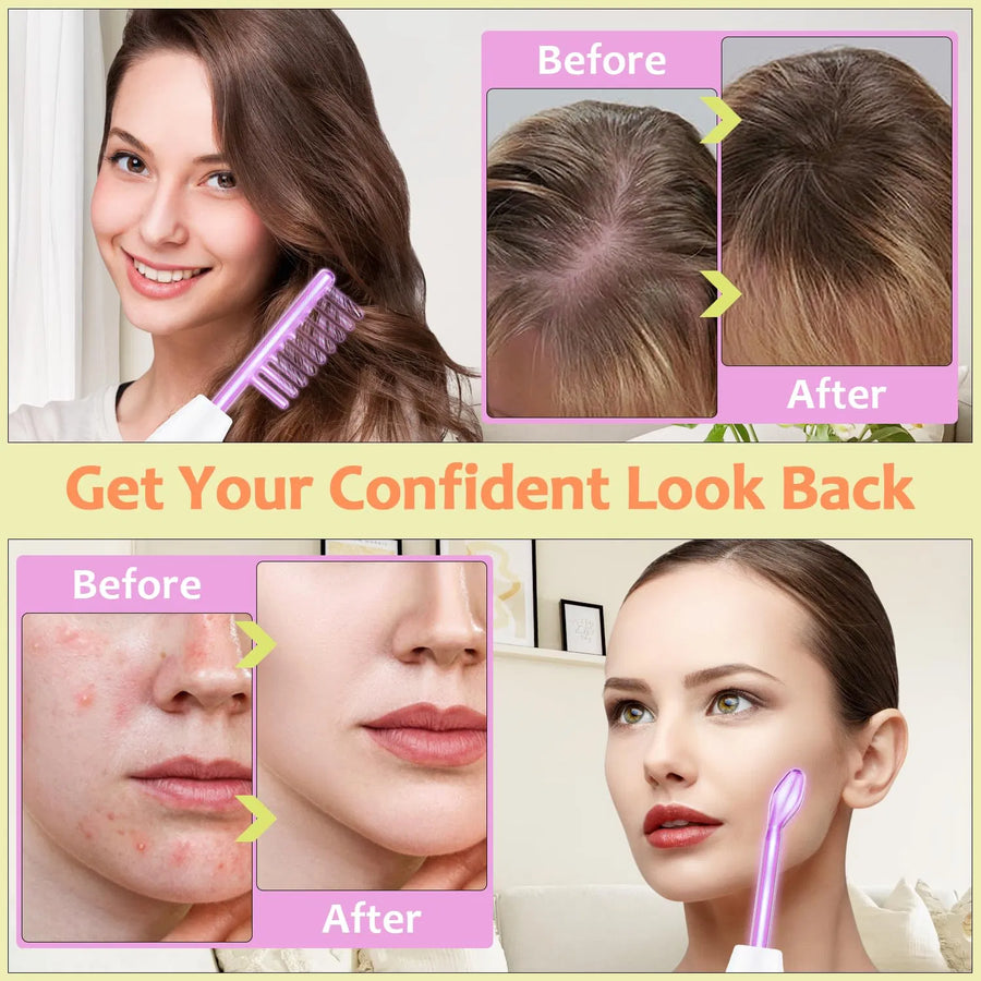 4-in-1 High Frequency Facial Wand – Violet Glow Skin Toning & Smoothing Device