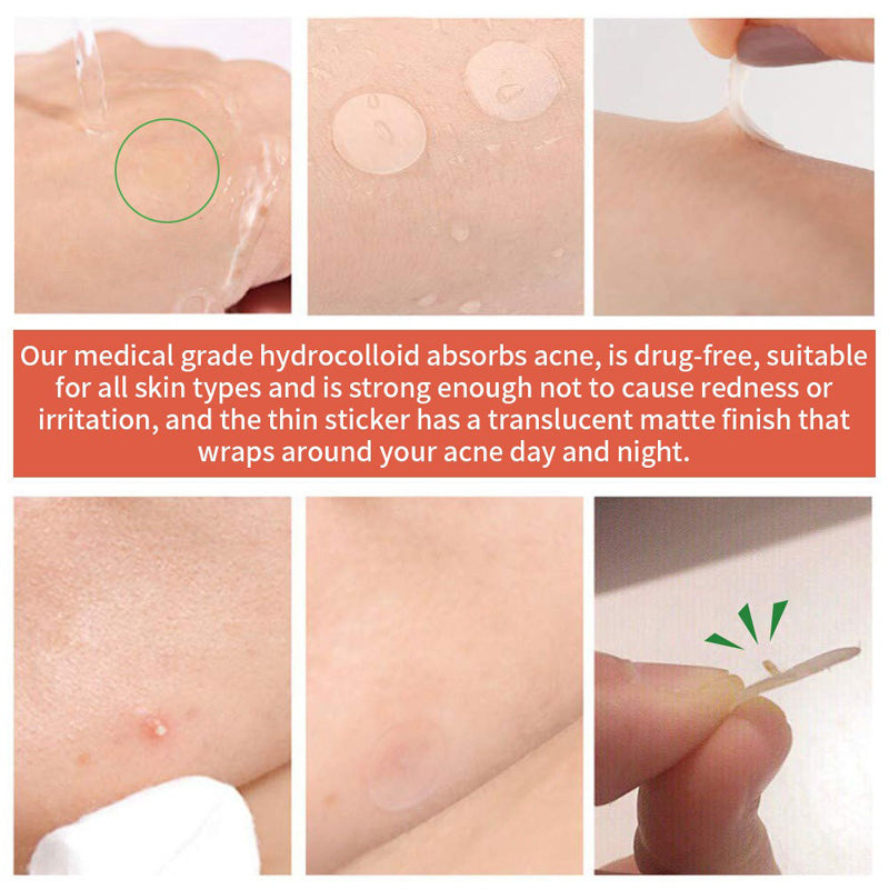 Overnight Pimple Patches – Shrink Zits & Whiteheads While You Sleep, 72 Count