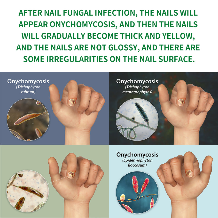 Ginger Nail Care Liquid – Strengthening Nail Treatment