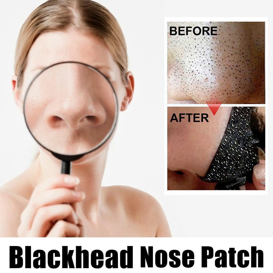 Deep-Clean Nose Pore Strips – Blackhead Removal, 10 Pack