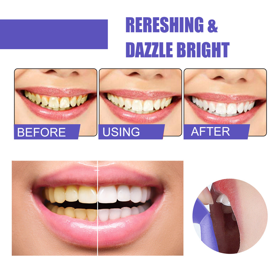 Foaming Whitening Toothpaste – Fresh Mint Stain-Lifting Mousse