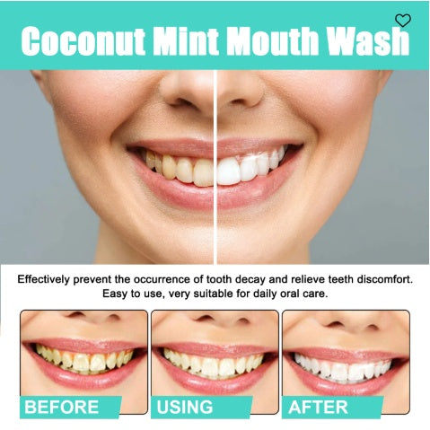 Coconut Mint Mouthwash – Fresh Breath Oral Rinse